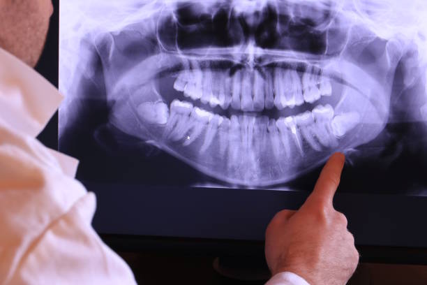Best Emergency Dental Extractions in Horseshoe Bay, TX