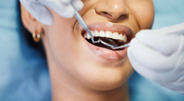 Best Emergency Dental Extractions in Horseshoe Bay, TX