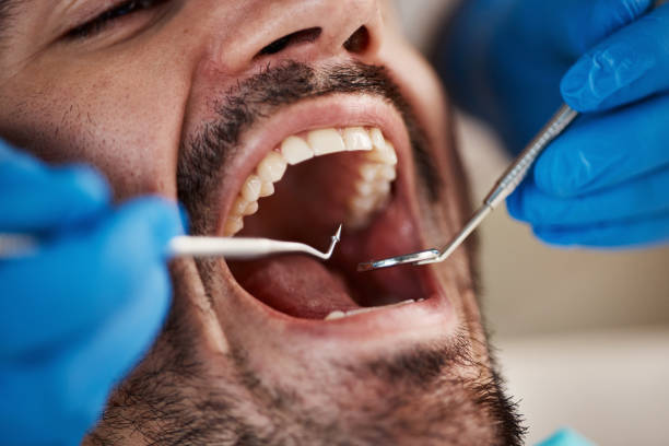 Best Emergency Dental Services for Seniors in Horseshoe Bay, TX