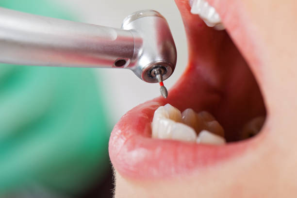 Best Weekend Emergency Dentist in Horseshoe Bay, TX